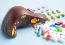 An anatomical model of a liver surrounded by various pills and medications