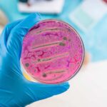 A hand holding a petri dish with pink bacterial growth