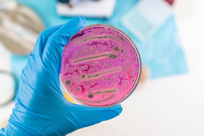 A hand holding a petri dish with pink bacterial growth