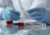 Ebola test tubes on lab table with gloved scientist in background