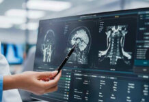 MRI Overread? The Costly MS Trap Doctor pointing at brain scans on a computer screen.